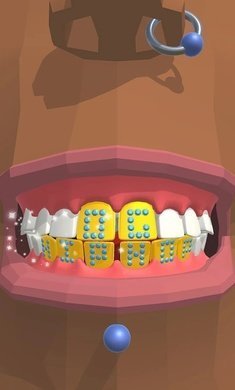 洗牙